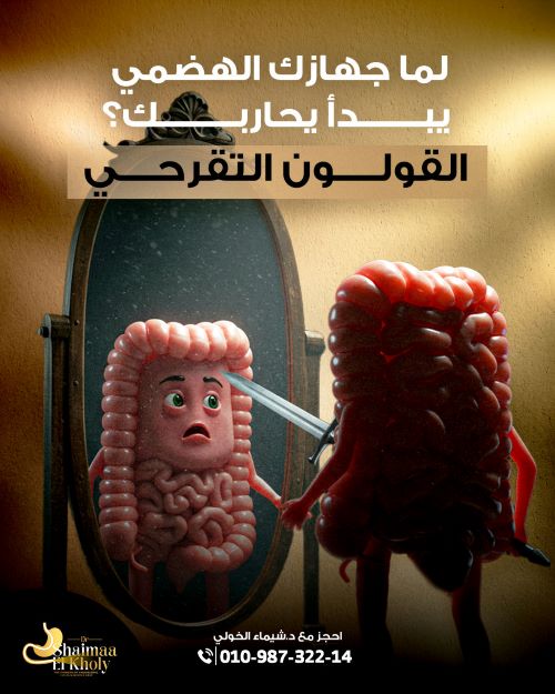 علاج القولون التقرحي